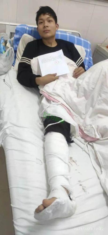 国道347发生惨烈车祸,姐弟俩小腿断裂,骨折.姐弟二人