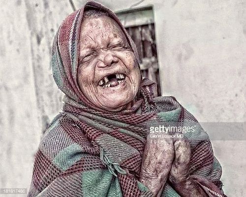 天花病毒是由欧洲殖民者带到美洲大陆的,传染性非常强,感染后会出现