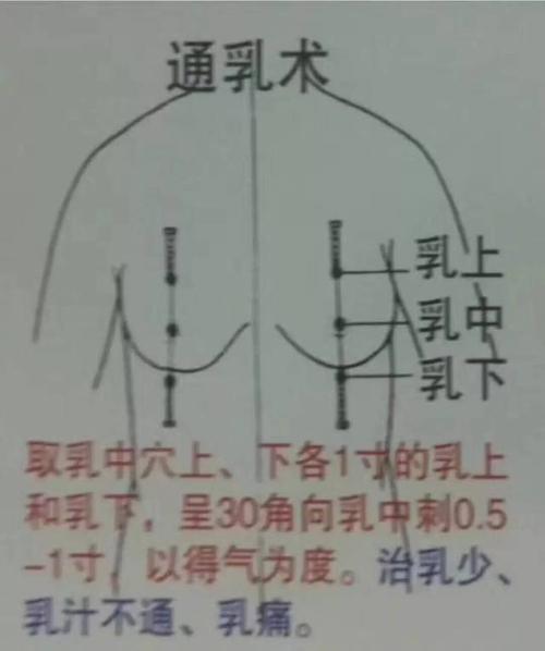 中医针灸各种刺法(图文讲解)
