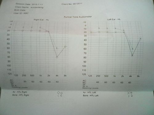 这张听力曲线图能看出什么?