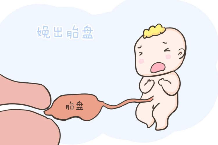 第三产程:娩出胎盘