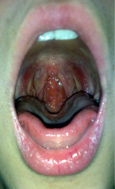 都快10年了.一直吃药一直好不了怎么办?