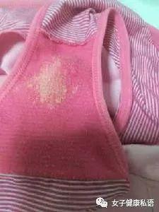 女性内裤上为啥总是"湿漉漉"?妇科主任告诉你,害羞也要看完!
