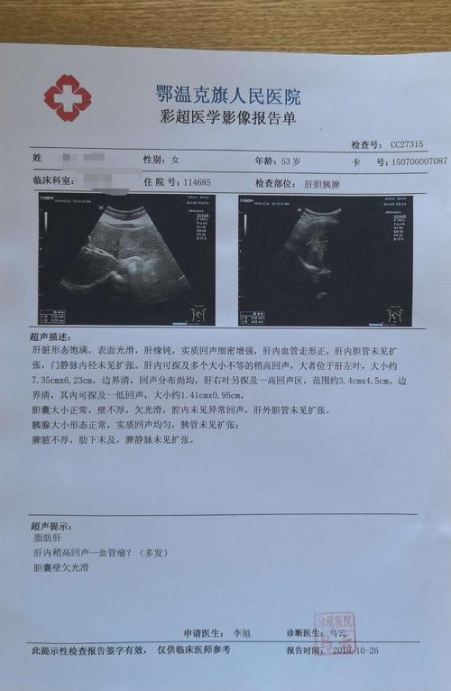 鄂温克旗人民医院普外科——完成首例肝血管瘤切除术