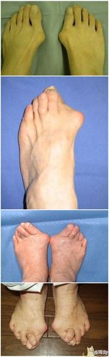 首页 图片 > 各种调皮任性的脚趾头   搞笑段子 07-18         个子