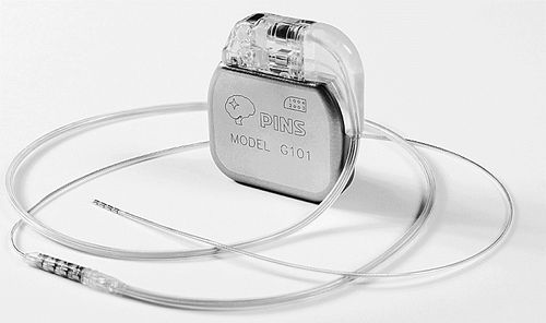 我国脑起搏器应用技术获得重大突破