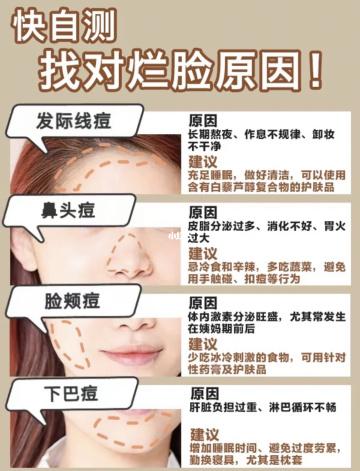 脸上长痘痘的原因