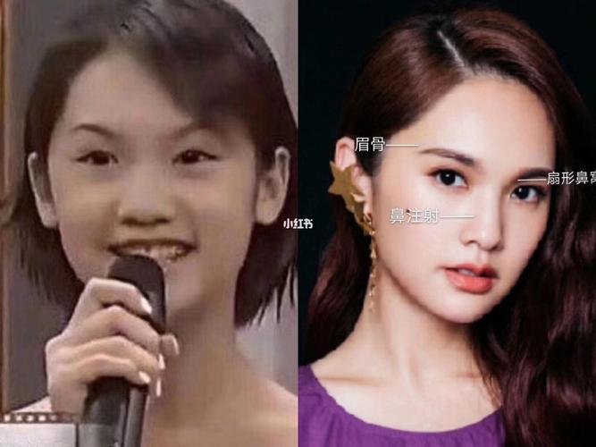 杨丞琳 变美之路 眉骨_杨丞琳_娱乐_明星娱乐资讯