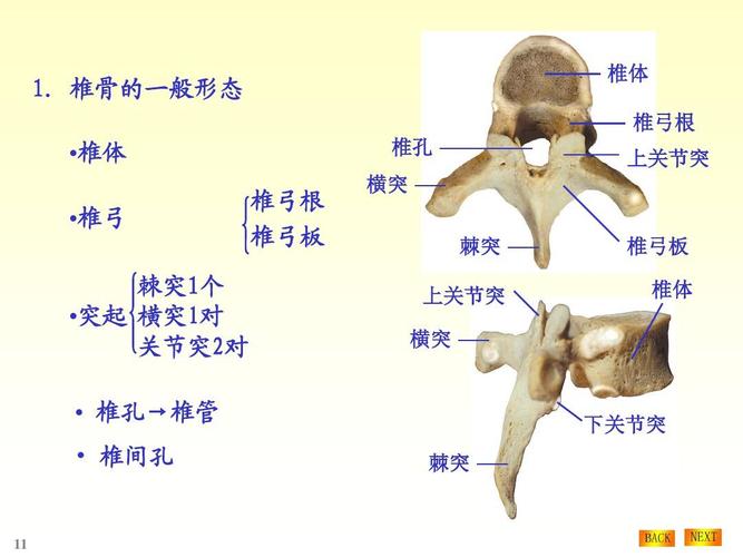 椎骨的一般形态  椎体  椎弓 椎弓根 椎弓板 椎孔 横突 棘突 上关节突