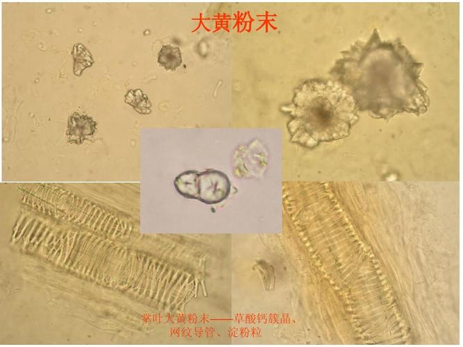 大黄粉末 掌叶大黄粉末——草酸钙簇晶, 网纹导管,淀粉粒