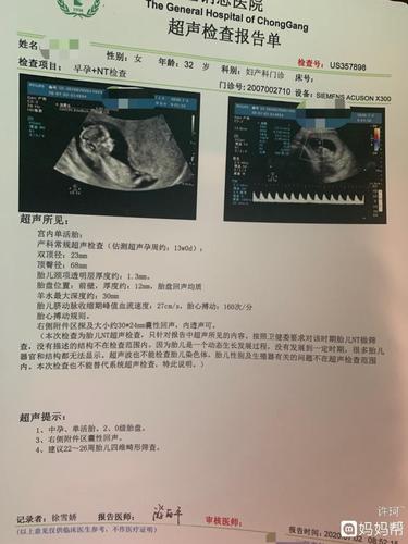 今天做了nt彩超检查,宝宝一切正常!在检