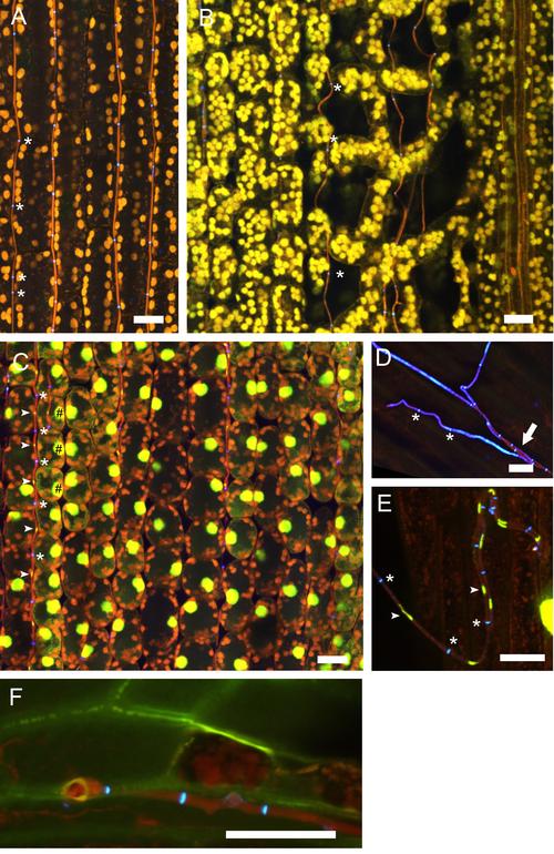 figure 6. endophytic and epiphyllous hyphae of  e.