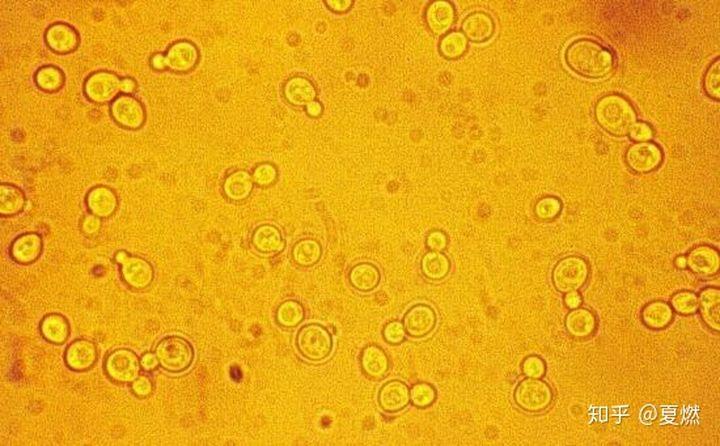 怎么跟老婆解释粪便常规中的霉菌狍子.一口咬定我出去