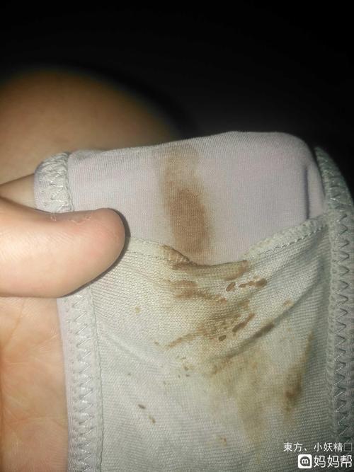 排卵期出血还是着床出血?