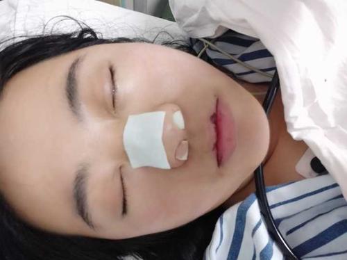 鼻窦炎手术的感觉如何手术前和手术后你有哪些想分享的