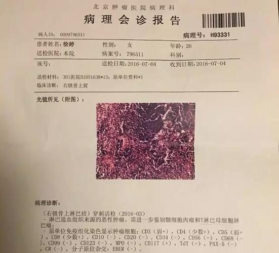 90后美女演员罹患淋巴癌,年仅26岁,重疾年轻化,保险要