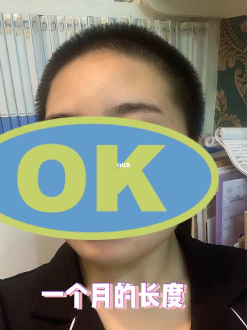 剃光头一个月了_发型_时尚_时尚_发型