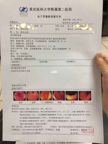 无痛胃镜,你值得拥有!_男朋友_阴影_胃镜_医疗健康