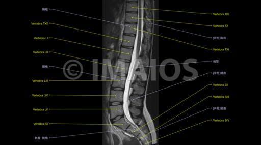 腰椎mri解剖图