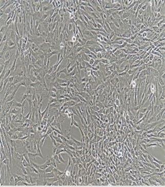 人口腔黏膜上皮细胞
