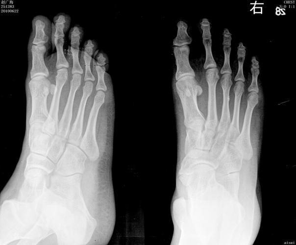 00:24:27   临床病史很简单:外伤,临床要求拍足正斜位,结果大意失荆州