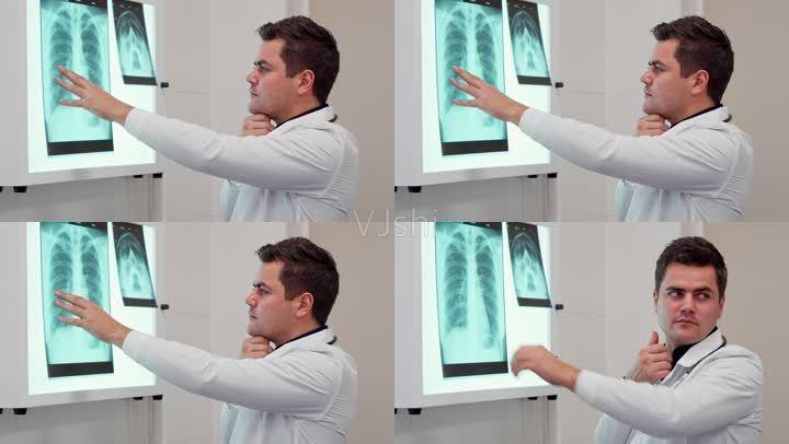 看x光片看胸片医院医疗