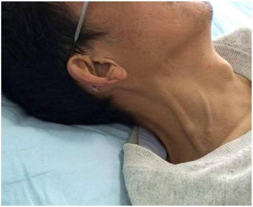 颈部青筋粗又壮,是什么原因?中医把真相说出来了