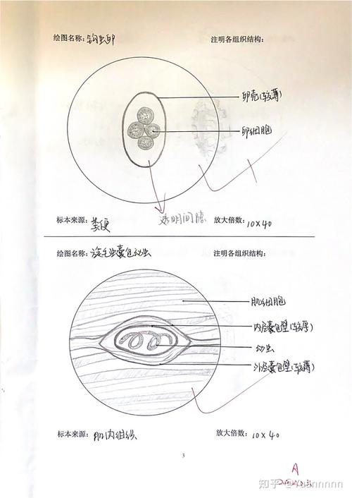 钩虫卵,旋毛虫囊包幼虫