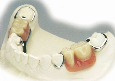 要想摆脱牙齿缺失的尴尬,很多人都会想到去医院修复缺失牙.