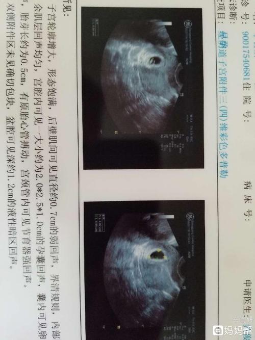 怎么知道是男是女