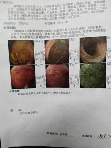 谁会看肠镜的病理检查报告,会看的解释一下内镜诊断那