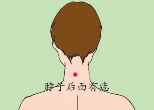 脖子后面 这颗痣体现了女性在婚姻生活中所遭遇的各种意外变故,不仅会