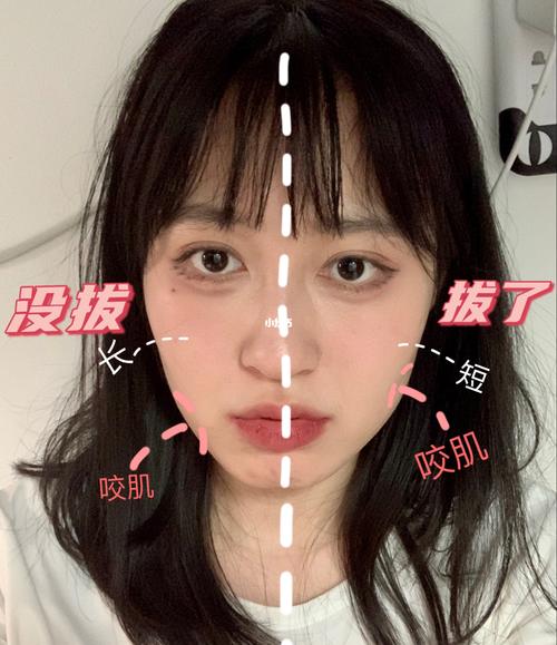 拔智齿脸型真的会改变!两边仿佛不是一个人_脸型_智齿