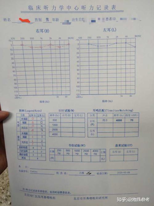 听力检查报告单