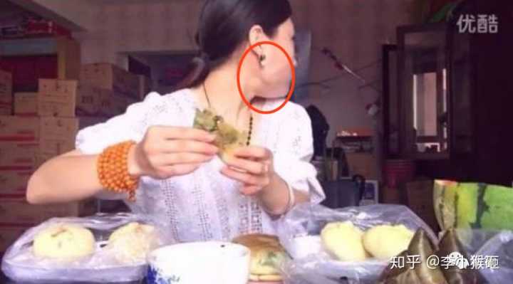 (图片来自新氧,长期催吐会导致甲状腺肿大,咬肌也很大~)