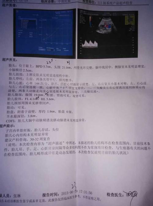 23周三尖瓣反流是什么意思,有问题吗