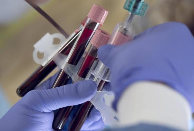 为啥一看病就要抽血?抽完的血,最后到哪去了?本文带你