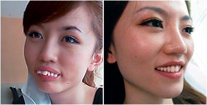 哪里矫正牙齿比较好