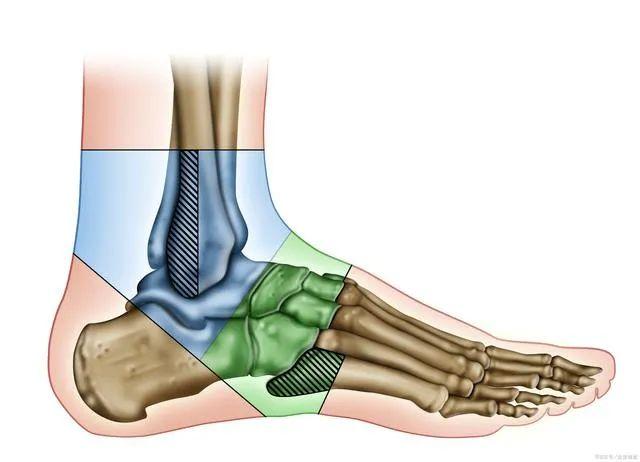 缓解足跟疼痛还可通过拉伸运动来缓解.
