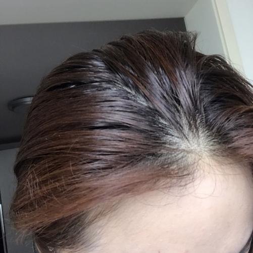 现在堪称头发比"黄金"贵~我就是标准的大油头,本来头发就细软贴头皮