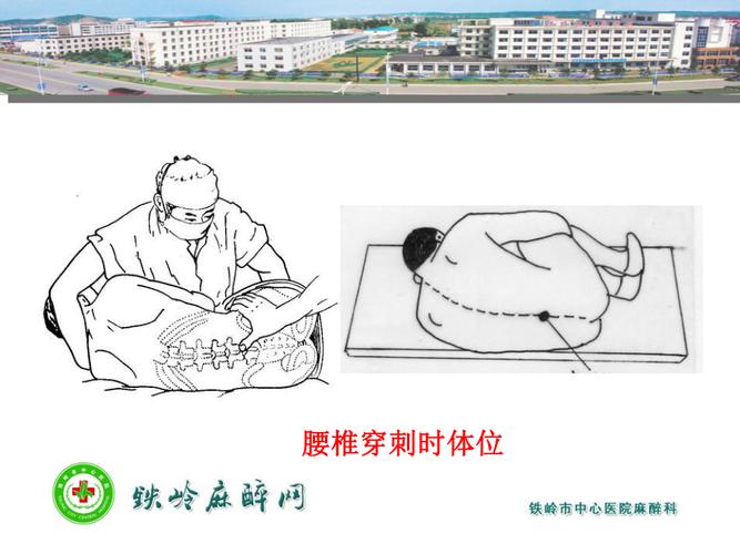 住培技能培训之腰椎穿刺术