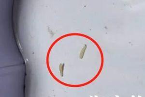 宠物狗未及时驱虫 浙江1岁宝宝感染罕见绦虫病