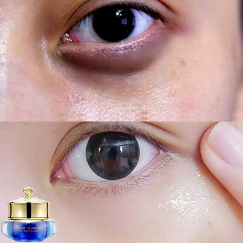 去眼皱纹眼袋精华霜 提拉紧致