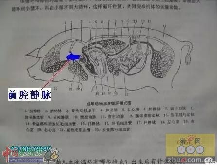 的小窝,将针从这两个小窝斜着向对侧肩关节顶端刺入,直接找前腔静脉窦