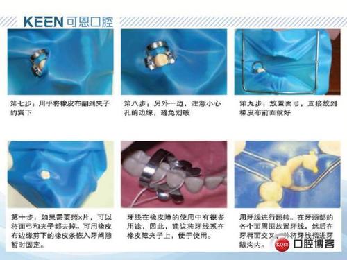 橡皮障的组成: 1 打孔器 2 橡皮障架 3 橡皮障钳 4 橡皮障夹 5 橡皮