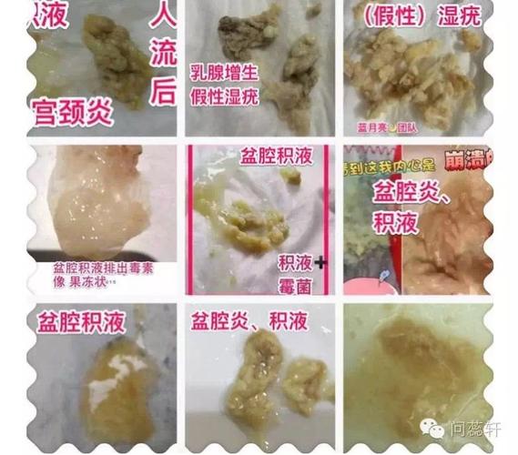 棒女郎排泄物超清图