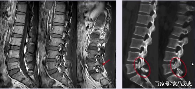 腰椎疼痛去拍片拍片时到底在干些什么呢