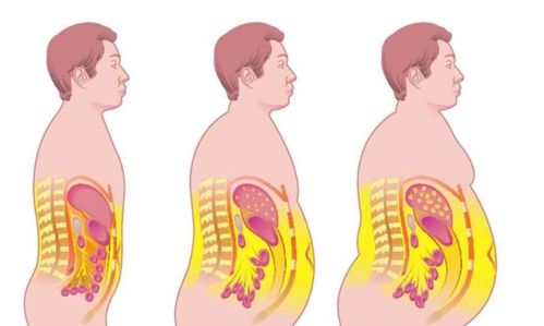 腹部脂肪与其他部位脂肪的区别,如何针对腹部进行减脂