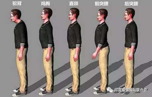 驼背是一种较为常见的脊柱变形,是胸椎后突所引起的形态改哟此次,主要