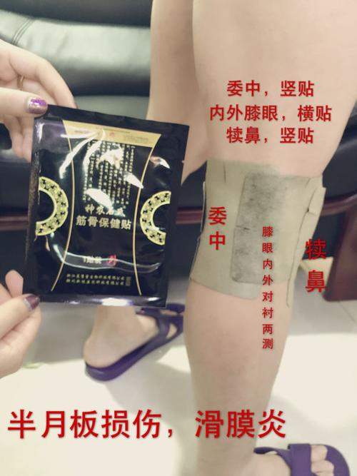 膝盖积液,滑膜炎,半月板损伤,骨质增生调理方法